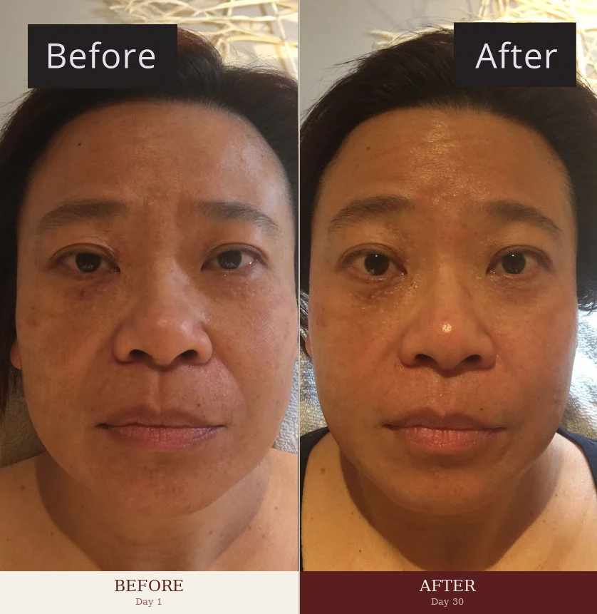 Before and after 30 days with Ecloria Beauty